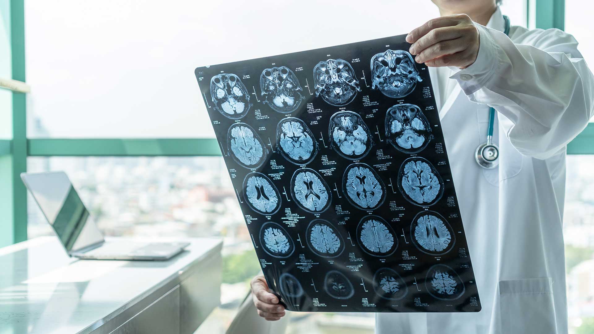 Traumatic Brain Injury Attorney